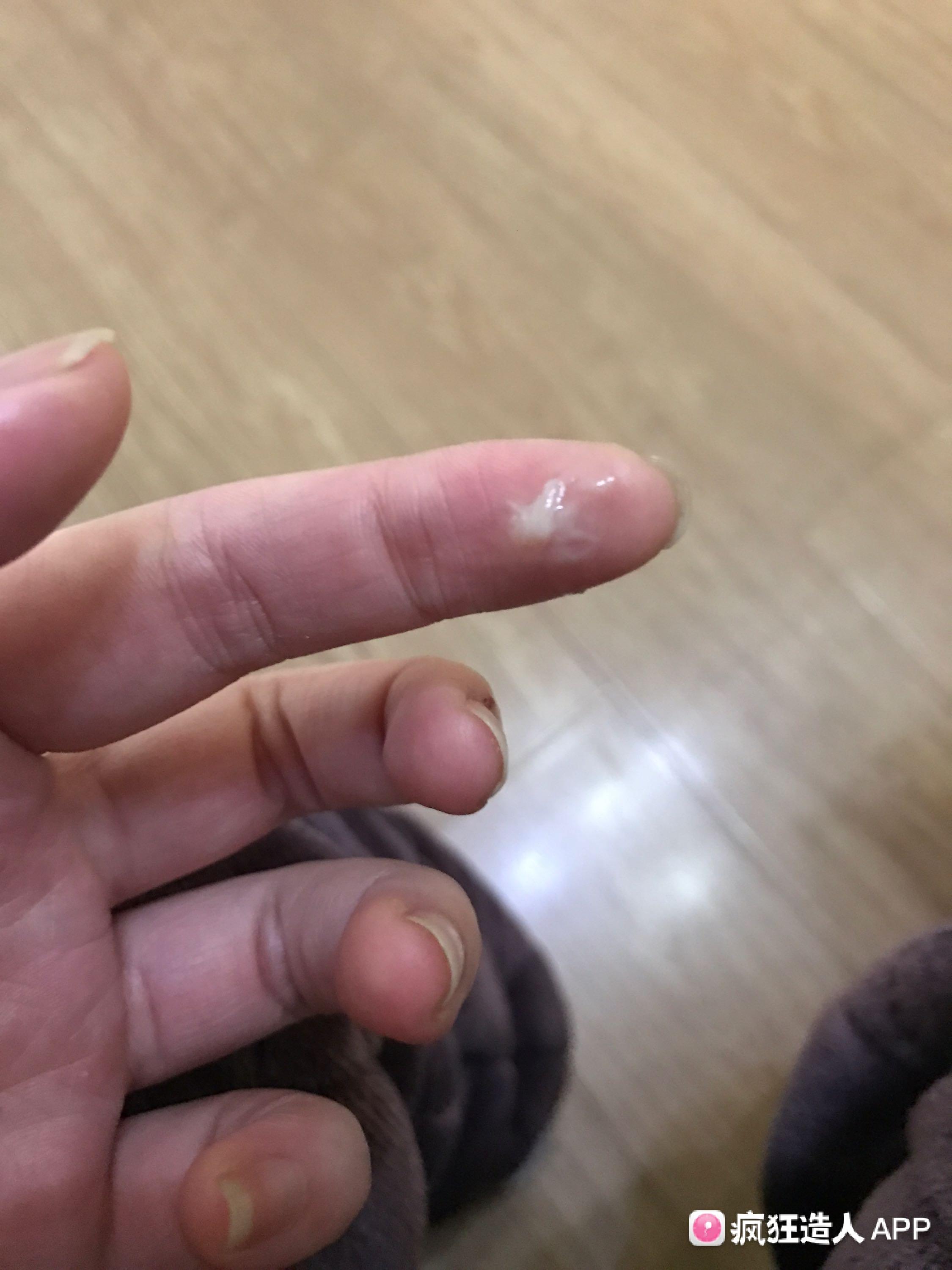 白带手机版百度下载并安装